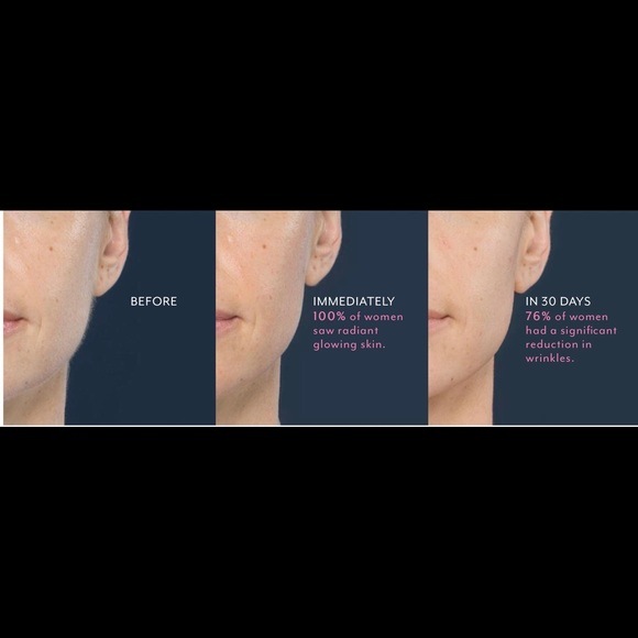 💚 $25 OFF DERMAFLASH LUXE DERMAPLANING TOOL - Picture 11 of 12